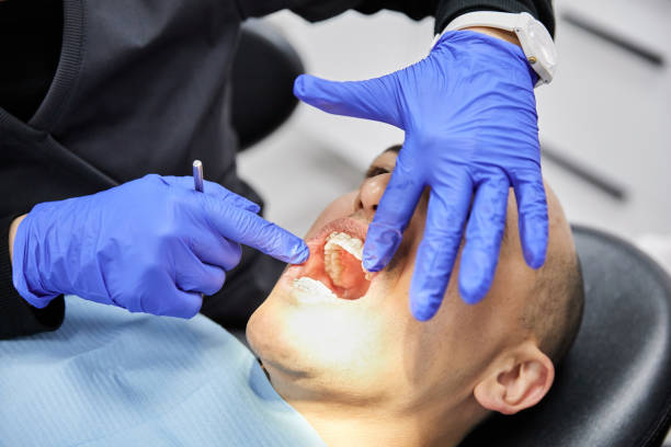 Best Emergency Wisdom Teeth Removal in Alamae, NC